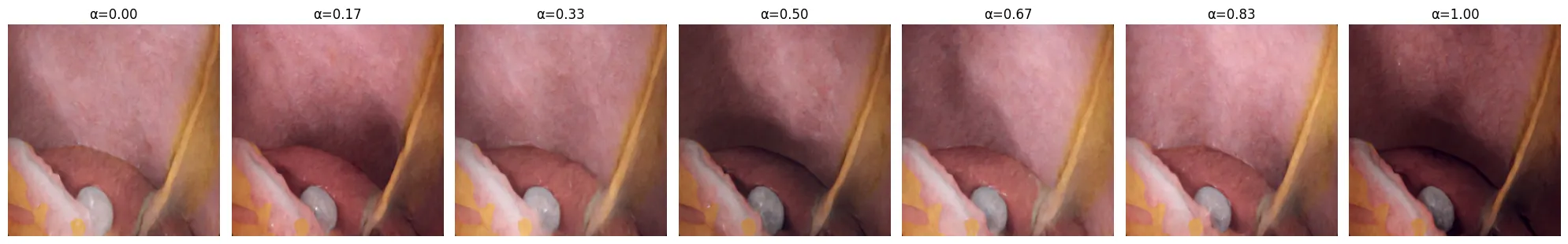 Seven versions of one surgical scene, shifting gradually in lighting and tone as alpha goes from 0 to 1.