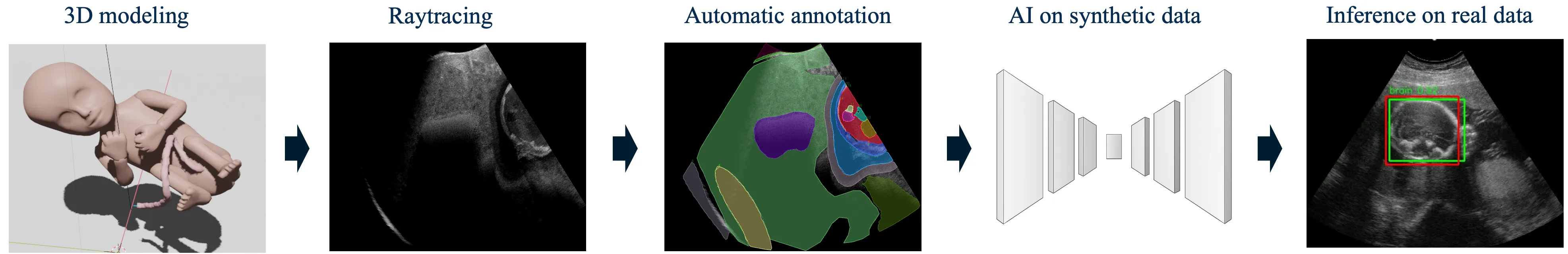 Five-stage pipeline from 3D model to ray-traced ultrasound, automatic annotation, training on synthetic data and inference on a real scan.